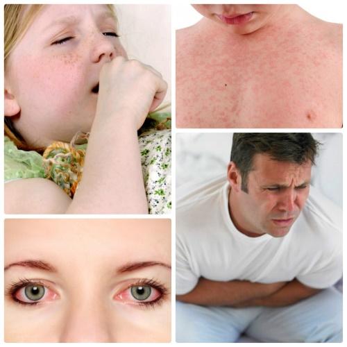 alerji semptomları