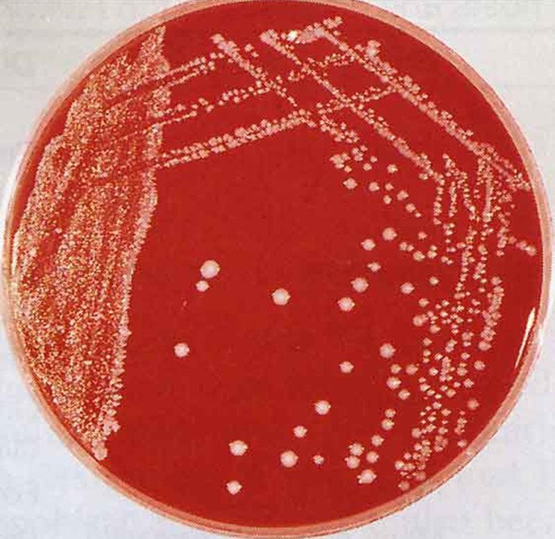 Krankheitserreger Bakterium Pasteurella